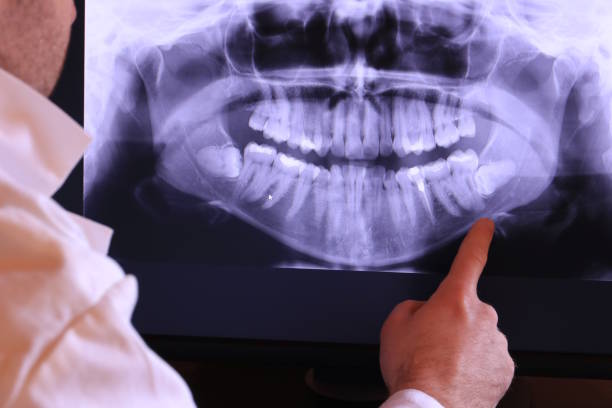 Best After-Hours Emergency Dentist in Georgetown, TX
