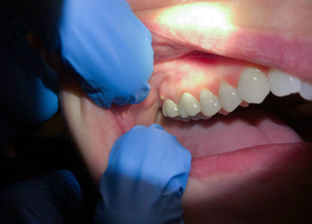 Best Emergency Dental Surgery in Georgetown, TX