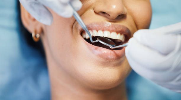 Best Emergency Root Canal Treatment in Georgetown, TX